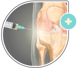 Tratamento com viscossuplementação com ácido-hialurônico em Brasília | Cetfisio